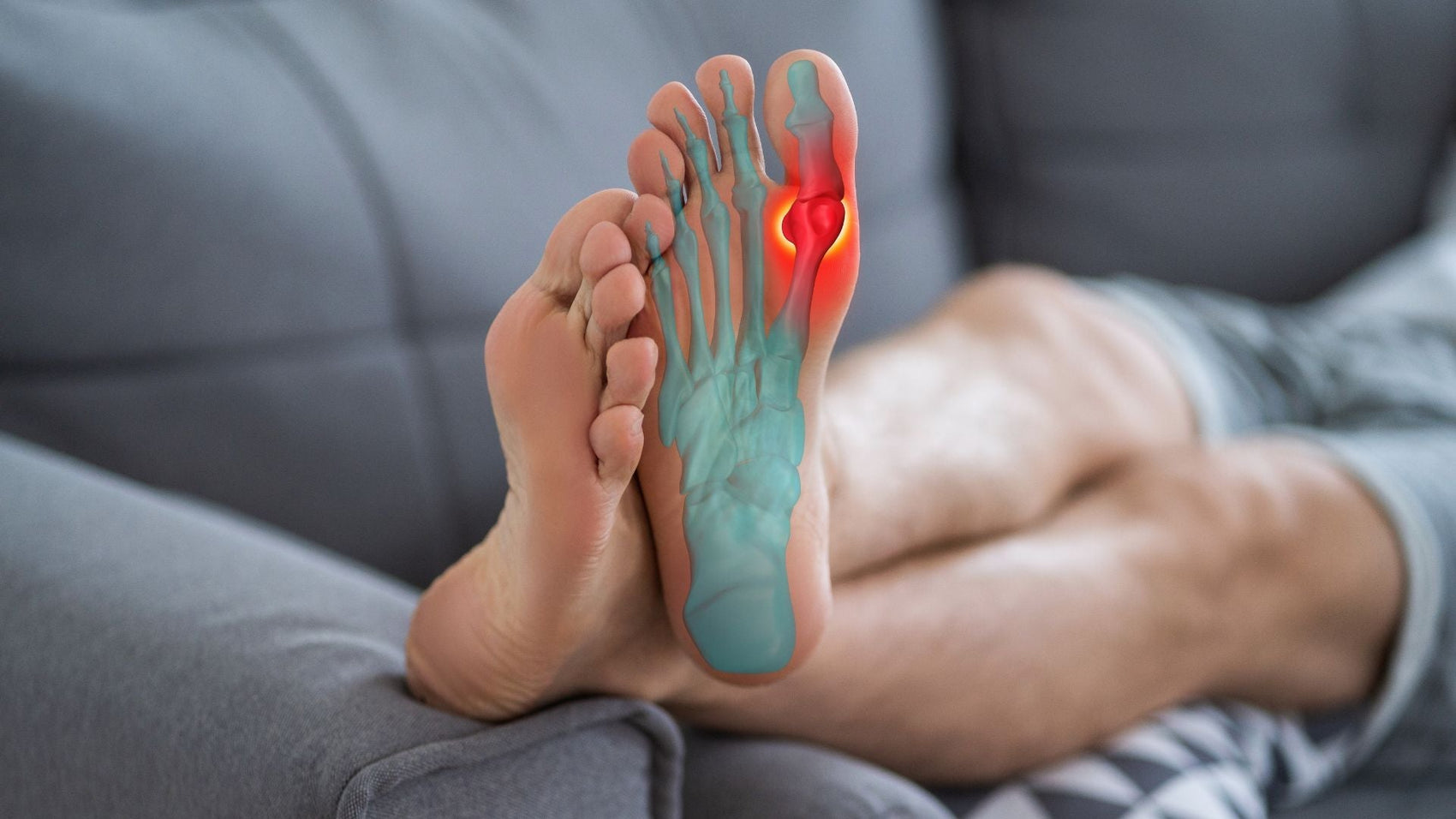 Gout: Types, Symptoms, Causes, Treatment, and More